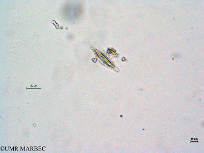 phyto/Thau_Lagoon/THAU_station1/GELAMED 2010/Cymbella sp (copy)_thumb.jpg
